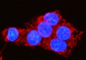 Immunofluorescent staining of FFPE human HepG2 cells with MOCS1 antibody (red) and DAPI nuclear stain (blue). HIER: steam section in pH6 citrate buffer for 20 min.