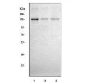 Western blot testing of human 1) HepG2, 2) HeLa and 3) SH-SY5Y cell lysate with MYT1L antibody. Predicted molecular weight ~133 kDa.