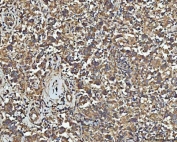 IHC staining of FFPE human testicular germ cell tumor tissue with NPEPPS antibody. HIER: boil tissue sections in pH8 EDTA for 20 min and allow to cool before testing.