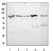 Western blot testing of 1) human PC-3, 2) human A549, 3) human 293T, 4) rat brain and 5) mouse brain tissue lysate with NPEPPS antibody. Predicted molecular weight ~103 kDa.