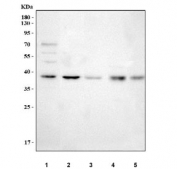 Western blot testing of 1) human HEL, 2) human 293T, 3) rat stomach, 4) mouse heart and 5) mouse stomach tissue lysate with MECR antibody. Predicted molecular weight ~40 kDa.