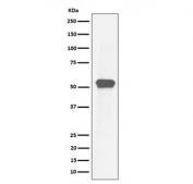 Western blot testing of human HeLa cell lysate with Myocyte enhancer factor 2A antibody. Predicted molecular weight: 46-55 kDa (multiple isoforms).
