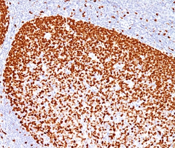 IHC testing of human human tonsil stained with PCNA antibody (PC10).~