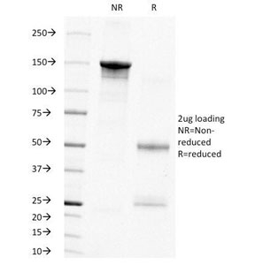 SDS-PAGE Analysis of Purified, BSA-Free PCNA Antibody (clone PC10). Confirmation of Integrity and Purity of the Antibody.