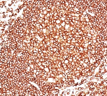 IHC: human tonsil stained with CD45 antibody~