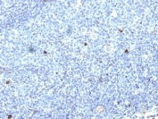 IHC: Formalin-fixed, paraffin-embedded human tonsil stained with HLA-Aw32 / HLA-A25 antibody (SPM418).