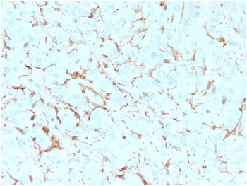IHC analysis of formalin-fixed, paraffin-embedded human adrenal gland stained with NGF Receptor antibody (clone SPM299).~