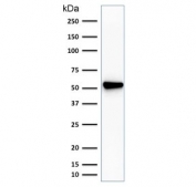 Western blot testing of Fascin antibody and human HeLa cell lysate (clone SPM133). Predicted molecular weight ~55 kDa.