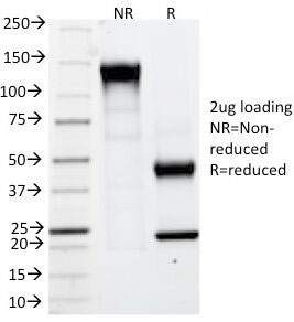 SDS-PAGE Analysis of Purified, BSA-Free CAIX Antibody (clone CA9/781). Confirmation of Integrity and Purity of the Antibody.