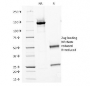 SDS-PAGE Analysis of Purified, BSA-Free Major Vault Protein Antibody (clone 1014). Confirmation of Integrity and Purity of the Antibody.