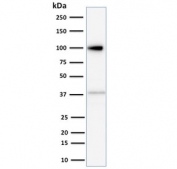Western blot testing of HeLa cell lysate with Major Vault Protein antibody (clone 1014). Observed molecular weight: 104~110 kDa.