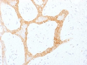 IHC analysis of formalin-fixed, paraffin-e
