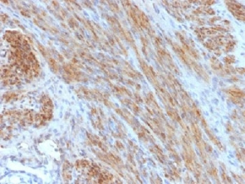 IHC testing of FFPE human uterus with Desmin antibody (clone DES/1711). Required HIER: boil tissue sections in 10mM citrate buffer, pH 6, for 10-20 min.~