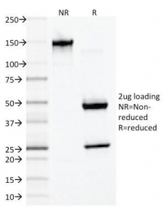 SDS-PAGE Analysis of Purified, BSA-Free Desmin Antibody (clone DES/1711). Confirmat