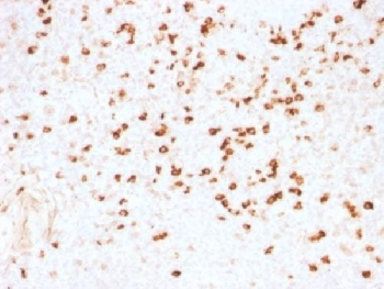 IHC testing of FFPE human tonsil stained with Lambda Light Chain antibody (clone N10/2). Required HIER: boil tissue sections in 10mM citrate buffer, pH 6, for 10-20 min.~
