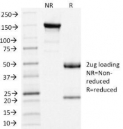 SDS-PAGE Analysis of Purified, BSA-Free Clathrin Light Chain Antibody (clone CLC/1421). Confirmation of Integrity and Purity of the Antibody.