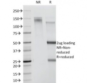 SDS-PAGE Analysis of Purified, BSA-Free CDw78 Antibody (clone DF1588). Confirmation of Integrity and Purity of the Antibody.