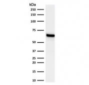 Western blot testing of human MCF-7 lysate with Estrogen Receptor alpha antibody (clone NR3Ga-2). Expected molecular weight ~67 kDa.