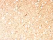 IHC testing of FFPE human brain with GAD67 antibody (clone GAD1/2391). Required HIER: boil tissue sections in 10mM citrate buffer, pH 6, for 10-20 min.