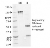 SDS-PAGE analysis of purified, BSA-free GAD67 antibody (clone GAD1/2391) as confirmation of integrity and purity.