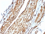 IHC staining of FFPE human testis tissue with Vinculin antibody (clone VCL/2575). HIER: boil tissue sections in pH9 EDTA buffer, for 10-20 min followed by cooling at RT for 20 min.