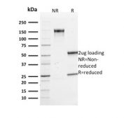 SDS-PAGE analysis of purified, BSA-free Vinculin antibody (clone VCL/2573) as confirmation of integrity and purity.