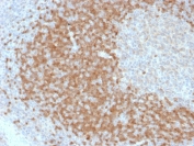IHC testing of FFPE human lymph node with TCL1 antibody (clone TCL1/2078). HIER: boil tissue sections in pH 9 10mM Tris with 1mM EDTA for 10-20 min followed by cooling at RT for 20 min.