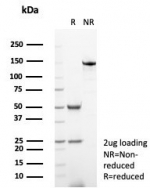 SDS-PAGE analysis of purified, BSA-free MGMT antibody (clone MGMT/7454) as confirmation of integrity and purity.