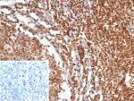 IHC staining of FFPE human testis tissue with MGMT antibody (clone MGMT/7454). Inset: PBS used in place of primary Ab (secondary Ab negative control). HIER: boil tissue sections in pH 9 10mM Tris with 1mM EDTA for 20 min and allow to cool before testing.