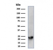 Western blot testing of human MCF-7 cell lysate with MGMT antibody (clone MGMT/7454). Predicted molecular weight ~22 kDa.