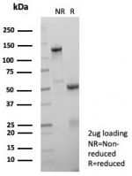 SDS-PAGE analysis of purified, BSA-free recombinant FLI1 antibody (clone FLI1/8318R) as confirmation of integrity and purity.