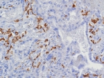 IHC staining of FFPE human placental tissue with CD163 antibody (clone M130/8361R). HIER: boil tissue sections in pH 9 10mM Tris with 1mM EDTA for 20 min and allow to cool before testing.