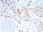 IHC staining of FFPE human tonsil tissue with recombinant CD163 antibody (clone M130/8821R). Inset: PBS used in place of primary Ab (secondary Ab negative control). HIER: boil tissue sections in pH 9 10mM Tris with 1mM EDTA for 20 min and allow to cool before testing.