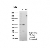 SDS-PAGE analysis of purified, BSA-free CD9 antibody (clone CD9/7417) as confirmation of integrity and purity.