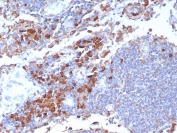 IHC staining of FFPE human lymph node tissue with CD9 antibody (clone CD9/7417). HIER: boil tissue sections in pH 9 10mM Tris with 1mM EDTA for 20 min and allow to cool before testing.