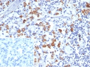 IHC staining of FFPE human lymph node tissue with CD163L1 antibody (clone CD163L1/7974). Inset: PBS used in place of primary Ab (secondary Ab negative control). HIER: boil tissue sections in pH 9 10mM Tris with 1mM EDTA for 20 min and allow to cool before testing.