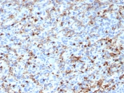 IHC staining of FFPE human spleen tissue with CD163L1 antibody (clone CD163L1/7971). HIER: boil tissue sections in pH 9 10mM Tris with 1mM EDTA for 20 min and allow to cool before testing.
