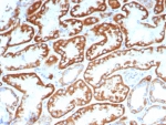 IHC staining of FFPE human kidney tissue with FGF23/6372 at 2ug/ml. HIER: boil tissue sections in pH 9 10mM Tris with 1mM EDTA for 20 min and allow to cool before testing.