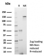 SDS-PAGE analysis of purified, BSA-free FGF23 antibody (clone FGF23/6372) as confirmation of integrity and purity.