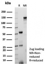 SDS-PAGE analysis of purified, BSA-free CD9 antibody (clone CD9/7416) as confirmation of integrity and purity.