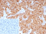 IHC staining of FFPE human pancreas tissue with CD9 antibody (clone CD9/7416). Inset: PBS used in place of primary Ab (secondary Ab negative control). HIER: boil tissue sections in pH 9 10mM Tris with 1mM EDTA for 20 min and allow to cool before testing.