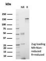 SDS-PAGE analysis of purified, BSA-free FGF23 antibody (clone FGF23/4579) as confirmation of integrity and purity.
