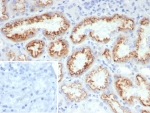 IHC staining of FFPE human kidney tissue with FGF23/6407 at 2ug/ml. Inset: PBS used in place of primary Ab (secondary Ab negative control). HIER: boil tissue sections in pH 9 10mM Tris with 1mM EDTA for 20 min and allow to cool before testing.