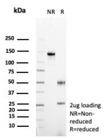 SDS-PAGE analysis of purified, BSA-free FGF23 antibody (clone FGF23/6419) as confirmation of integrity and purity.
