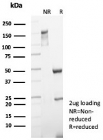 SDS-PAGE analysis of purified, BSA-free recombinant KRT5 antibody (clone rKRT5/6969) as confirmation of integrity and purity.