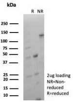 SDS-PAGE analysis of purified, BSA-free Cytokeratin 5 antibody (clone KRT5/8814R) as confirmation of integrity and purity.