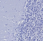 Negative control: IHC testing of FFPE human brain tissue with Cytokeratin 5/6 antibody (clone KRT5.6/8275R) at 2ug/ml. HIER: boil tissue sections in pH 9 10mM Tris with 1mM EDTA for 20 min and allow to cool before testing.
