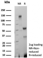 SDS-PAGE analysis of purified, BSA-free Decorin antibody (clone DCN/8760R) as confirmation of integrity and purity.