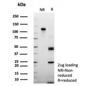 SDS-PAGE analysis of purified, BSA-free recombinant POSTN antibody (clone rPOSTN/8522) as confirmation of integrity and purity.