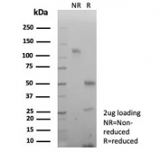 SDS-PAGE analysis of purified, BSA-free recombinant Decorin antibody (clone DCN/8715R) as confirmation of integrity and purity.